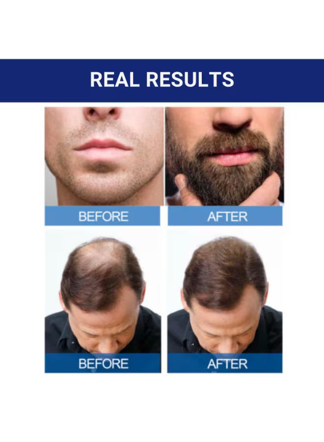 6-Pack Minoxidil 5% Extra Strength Hair Regrowth Solution – 60ml Bottles