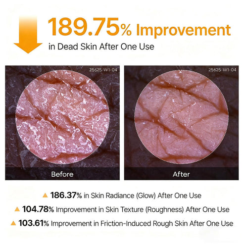 Alzarii Peel Shot - Kojic + Turmeric Body Peel Spray