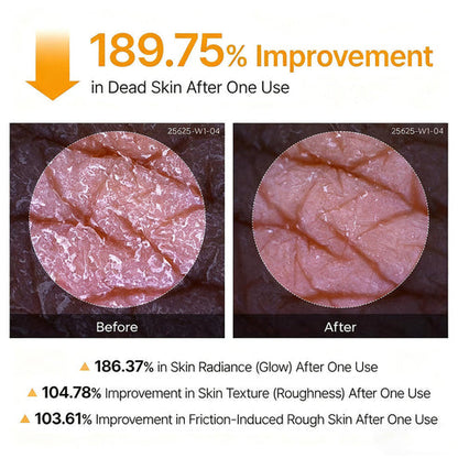Alzarii Peel Shot - Kojic + Turmeric Body Peel Spray