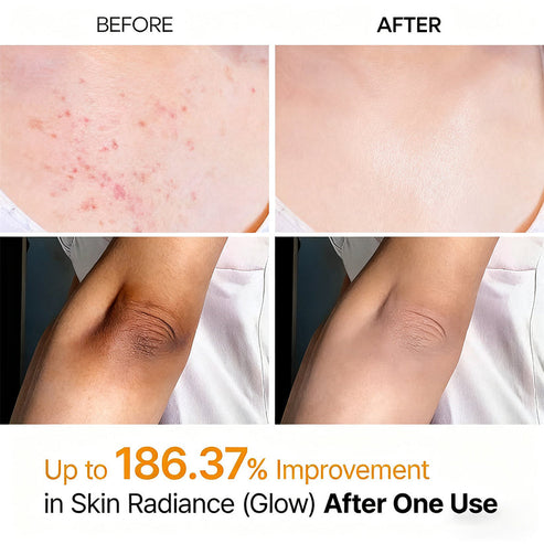 Alzarii Peel Shot - Kojic + Turmeric Body Peel Spray